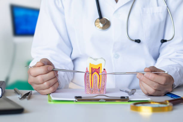 Best Knocked-Out Tooth (Avulsed Tooth) Treatment in Burnettown, SC